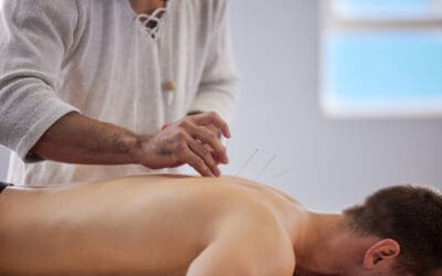 Acupuncture and Herbs: A Natural Health Combo